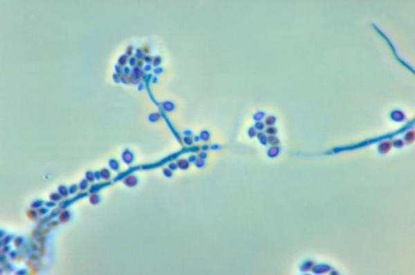 Sporotrichosis kissoilla - syyt, oireet ja hoito - Sporotrichosis -diagnoosi kissoilla